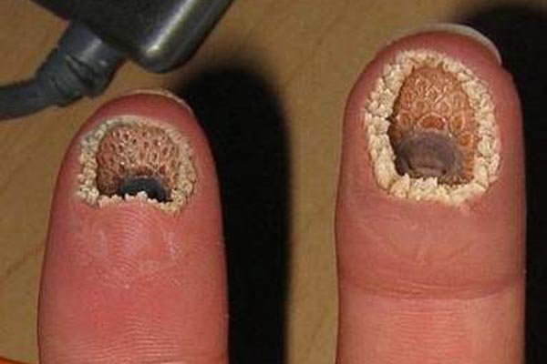 ����ָ��ɶ ����ϳ�ͼƬ�����Ŀֻ�������