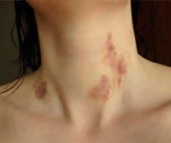 �ֲ�ݮ��ʲô��˼�� ���鱳��������������������