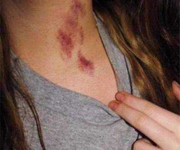 种草莓是什么意思啊 激情背后让人脸红心跳的尴尬