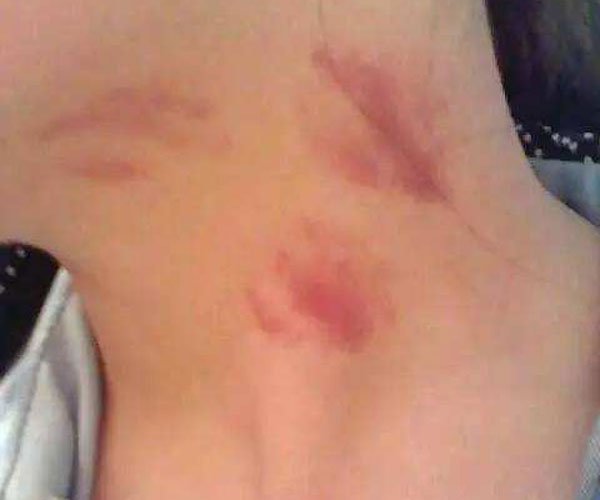 种草莓是什么意思啊 激情背后让人脸红心跳的尴尬