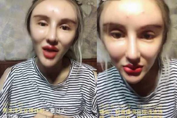 桃花宝宝整容前照片 整容上瘾原本长相已找不到