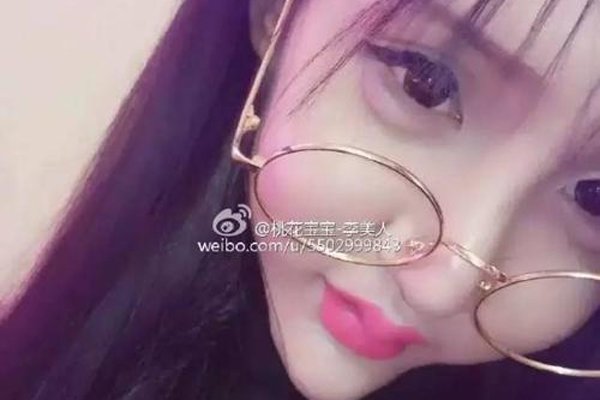 桃花宝宝整容前照片 整容上瘾原本长相已找不到