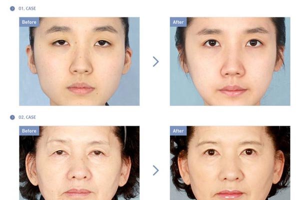 ��ʮ�����δ�ȫͼ�� ����������Ϊ���ĵ��۾�