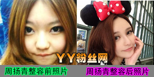 ����������ǰ����Ƭ�Ա� �������ͥ���� ������ҵı���