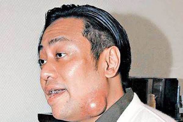 ���׻ԵĶ�����ʲô�� �͸���žž��ʱ�����Ƕ�������