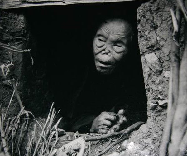 ����Ϊʲô����粡 ��������������Զ�����ֲ�ԭ��