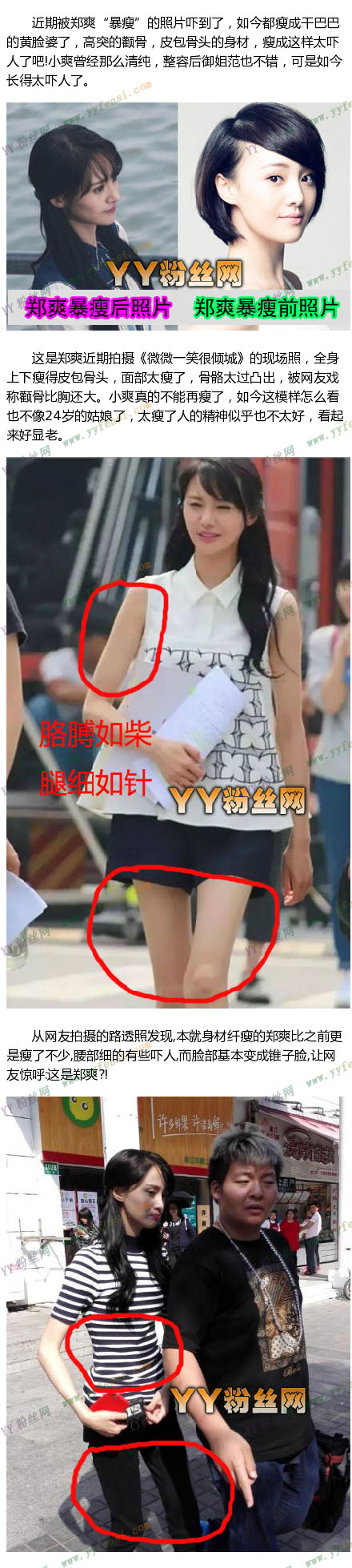 ֣ˬ����ԭ����� ֣ˬ����ǰ����Ƭ�Աȹ�����������ֽ��