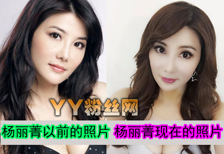 杨丽菁整容前后照片对比脸僵变丧尸 杨丽菁结婚了吗老公是谁