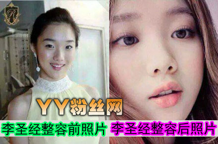 ��ʥ������ǰ����Ƭ�Ա� ��ʥ��͸��װͼƬ�����Ըг�����