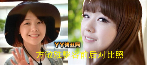 方敏雅男朋友是谁深夜约会孙兴民被偷拍 方敏雅整容前照片对比