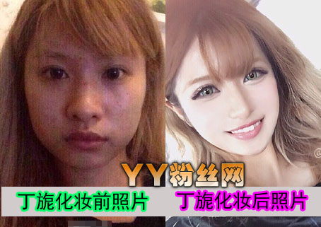 �������ǰ����Ƭ�ԱȱȻ������� ģ�ض����°�������ͼƬ�ع�