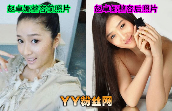 ��׿������ǰ��Ƭ�Ա�ͼ ���ѳ������նԱȲ���