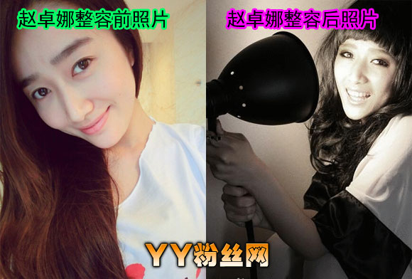 ��׿������ǰ��Ƭ�Ա�ͼ ���ѳ������նԱȲ���