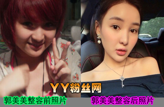 ����������ǰ����Ƭ�Ա���������