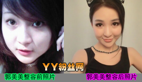 ����������ǰ����Ƭ�Ա���������