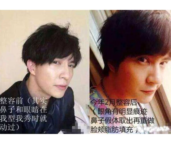 薛之谦车祸整容前照片 大家被蒙蔽了原来这都是套路