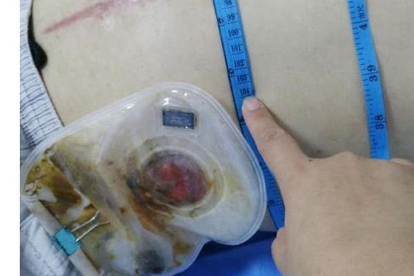 �˹������ű�ö��� �����������ʱ�ᷢ����