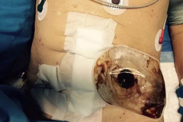 �˹������ű�ö��� �����������ʱ�ᷢ����