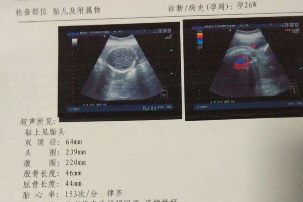 �Ÿ���׼���к����� ûǮ���к�����ʲô��