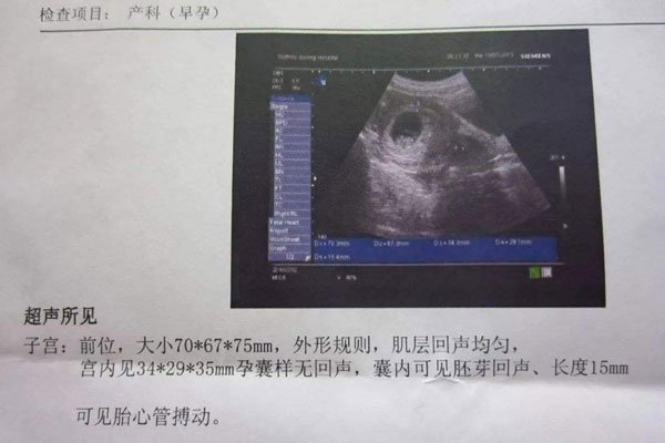 �Ÿ���׼���к����� ûǮ���к�����ʲô��