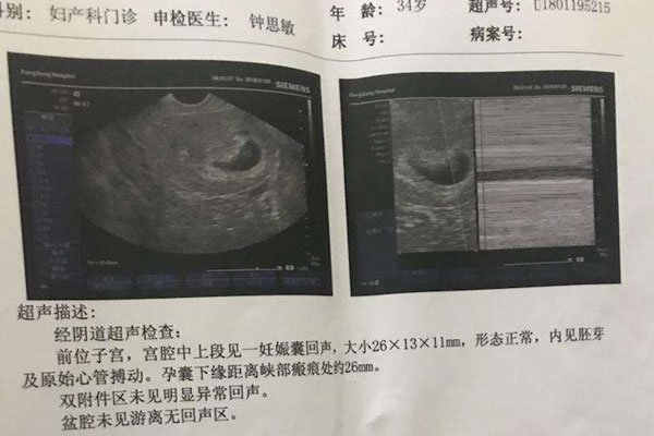 �Ÿ���׼���к����� ûǮ���к�����ʲô��