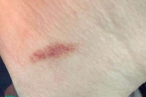 �ֲ�ݮ��ʲô��λ��ȫ ���������������ò�Ҫ��