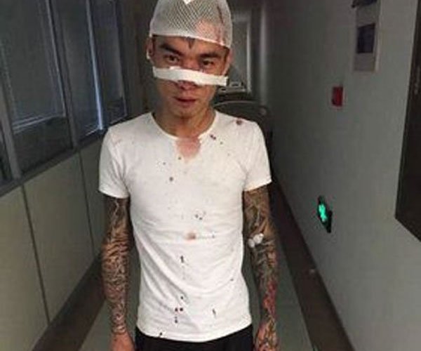 �ż������۴�ܵ���Ƶ��ͼ ����������Ҫ����