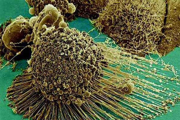 ����ϸ��Ϊʲô������ �����ֺ����õ���ʲô����