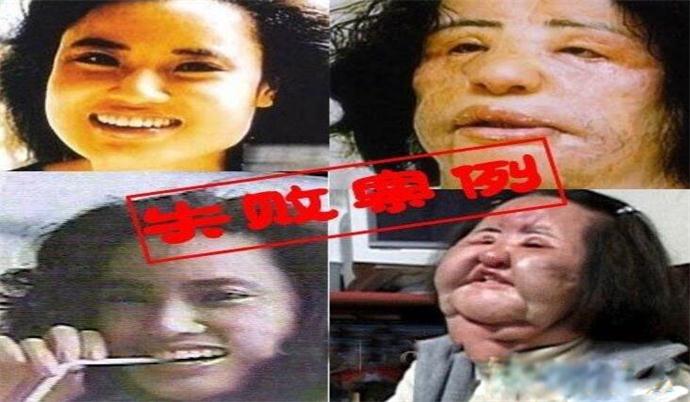 �����ԭ�������ڵ�����ͼƬ ���������ʧ����Ƭ