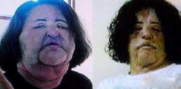 �����ԭ�������ڵ�����ͼƬ ���������ʧ����Ƭ