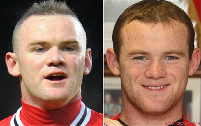 ³�ᷢ�ͱ�ǨͼƬ ³���ͷ������ô��������