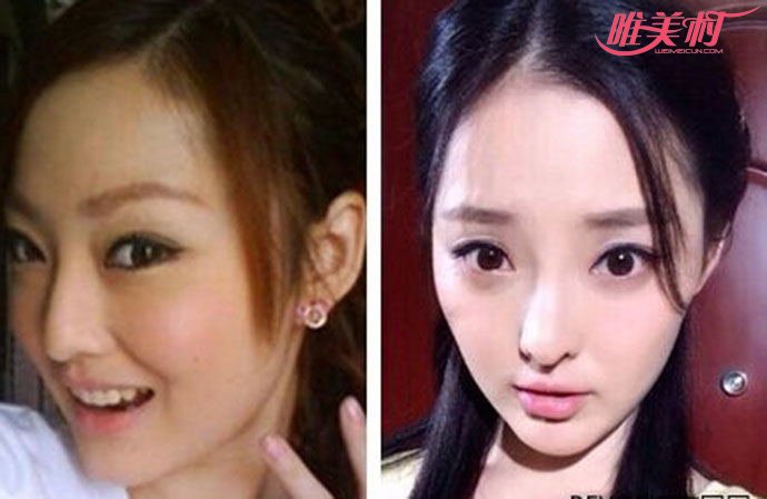 �����ؽ������ ����������ǰ����Ƭ