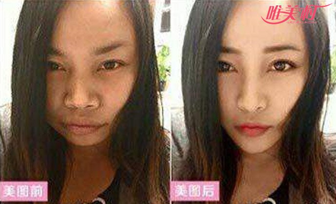 ������ݺ���Ƭ �⻹�Ǵ����ʶ�ķ����