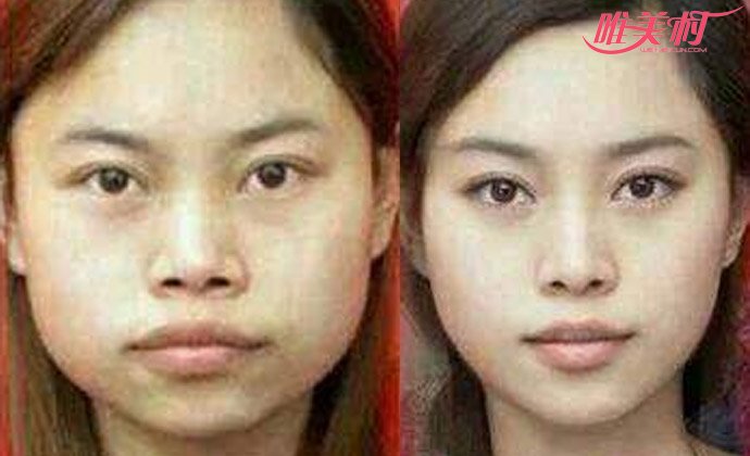 ������ݺ���Ƭ �⻹�Ǵ����ʶ�ķ����