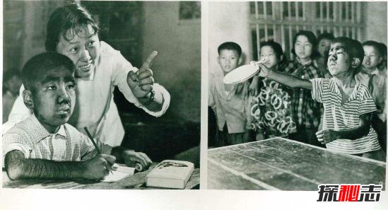 ë���������� ΪʲôҪ��ë���������