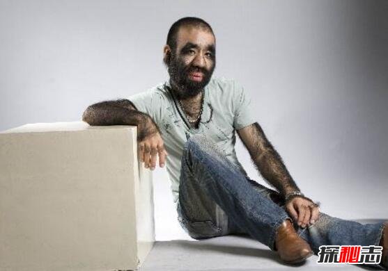 ë���������� ΪʲôҪ��ë���������