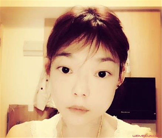 ���Ǻ���ǰ����Ư������Ƭ ���Ǻ���״���������Ƭ