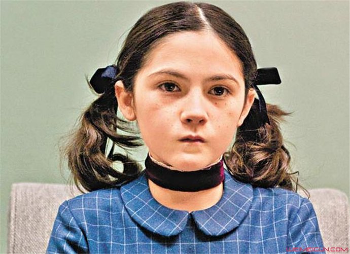 ����֢��Ĵ����� ����֢��ʲô���ܻ���