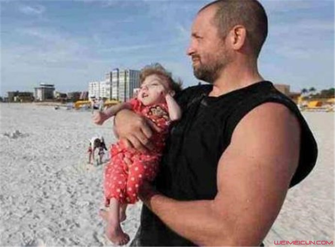 ����֢��Ĵ����� ����֢��ʲô���ܻ���