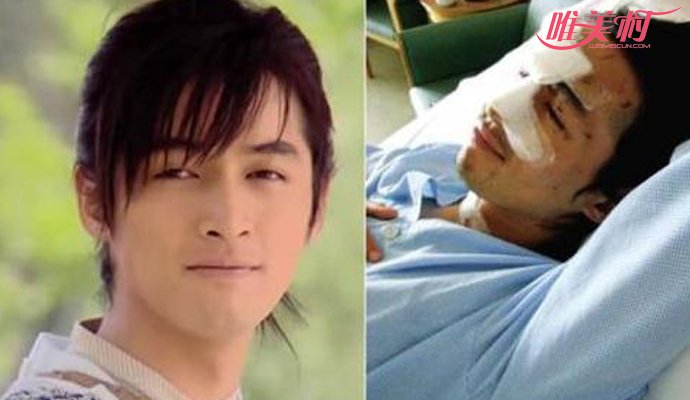 ���賵���¼�˭���� ����������Զ�������۾�