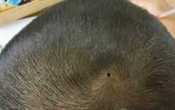 男人10处有痣是富贵痣图解 耳朵有痣的男人代表什么意思