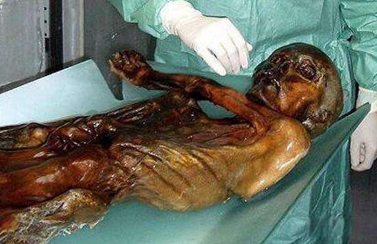 ��������Ư����ʬ�� ���˰´ĸ�ԭͼ����