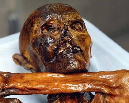 ��������Ư����ʬ�� ���˰´ĸ�ԭͼ����