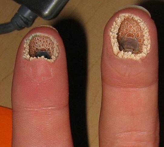 �����ѵĿֲ��ʻ�ͼƬ ������Ƭ��ͺ����