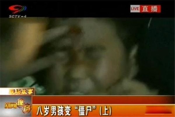 重庆男孩变僵尸事件真相 八岁男孩变成僵尸是真的吗