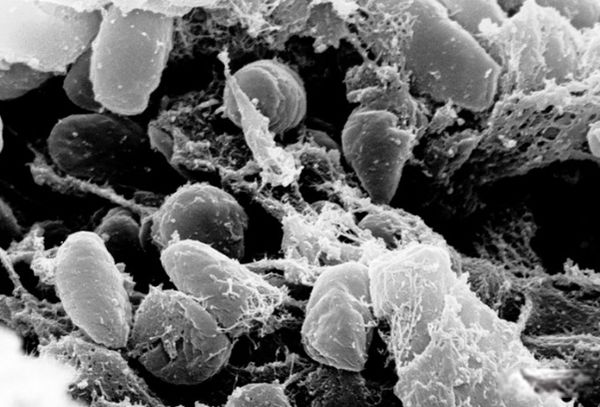 ��������ʲô��? ŷ�޺�������ʷ�¼�����