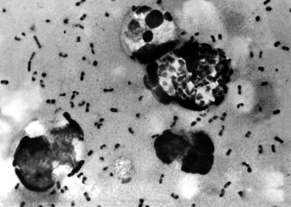 ��������ʲô��? ŷ�޺�������ʷ�¼�����