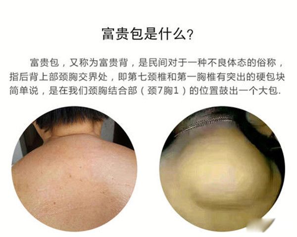 ���������ô�γɵ���ô���� ��������ĸ�λ��ͼƬ