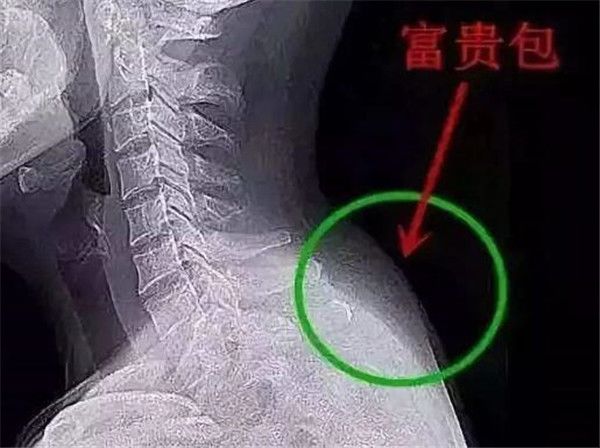 ���������ô�γɵ���ô���� ��������ĸ�λ��ͼƬ