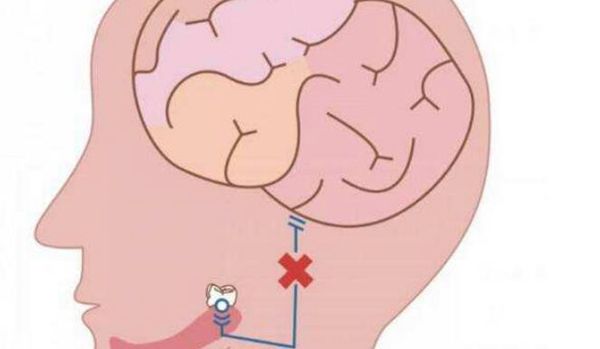 拔智齿会很疼吗 拔智齿注意事项与禁忌后悔了